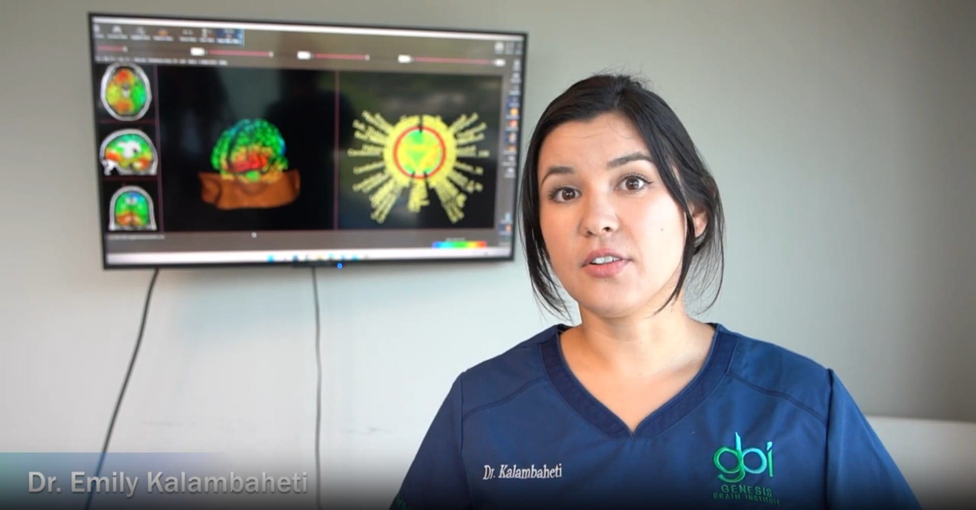 What is a qEEG Brain Map