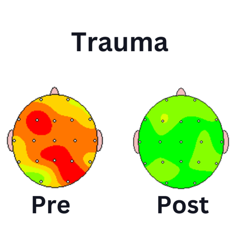 Brain-Treatment-Center