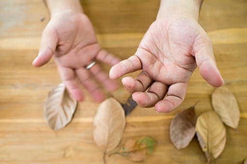 Parkinsons Treatment FL