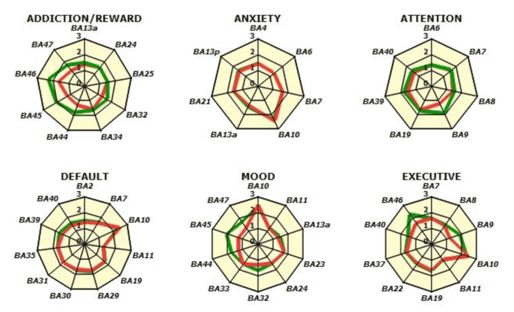 Concussion Test Tampa Bay