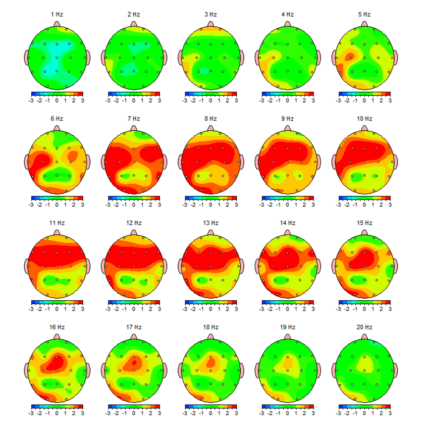 Addiction and the brain