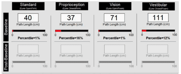 Balance Test in Tampa Florida