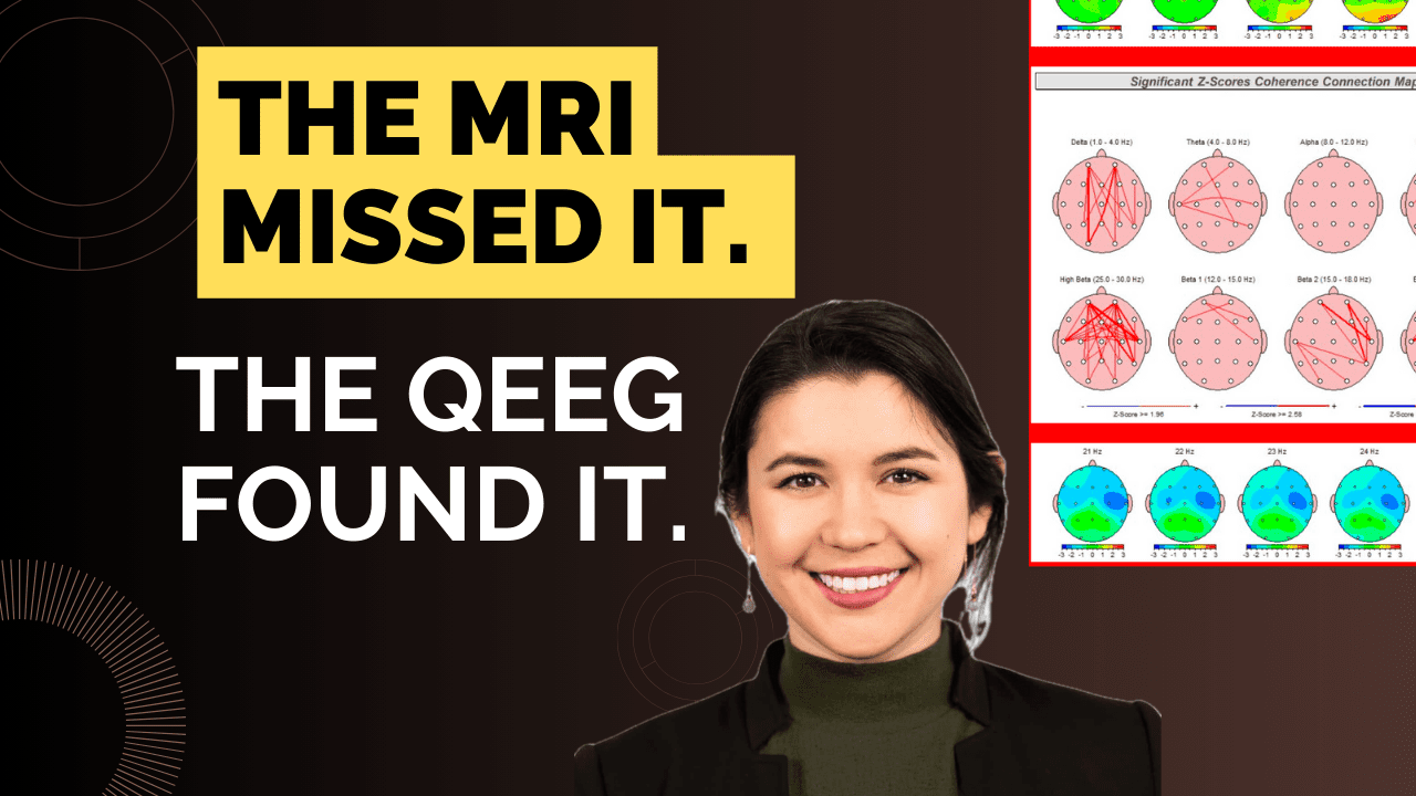 Rehabilitation for Brain Injuries