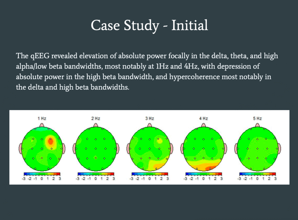 qEEG TBI Case Study