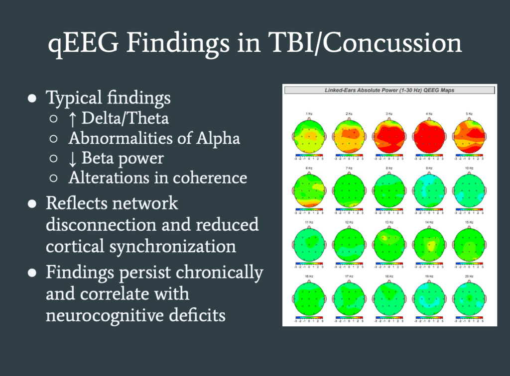 qEEG TBI Findings