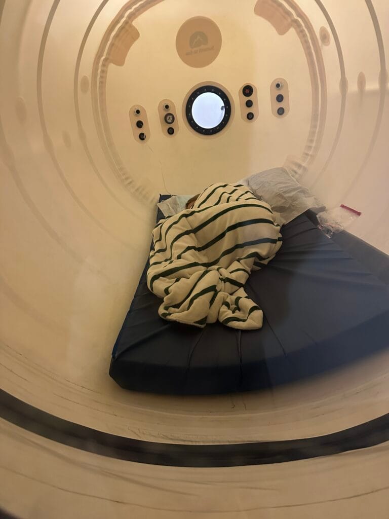 hyperbaric oxygen treatment mtbi