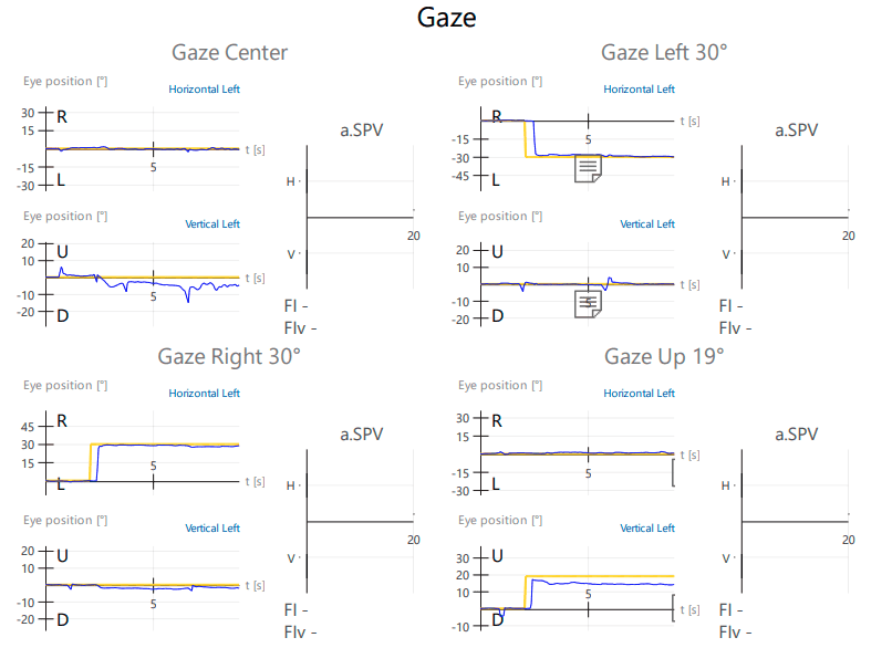 Eye Gaze Test