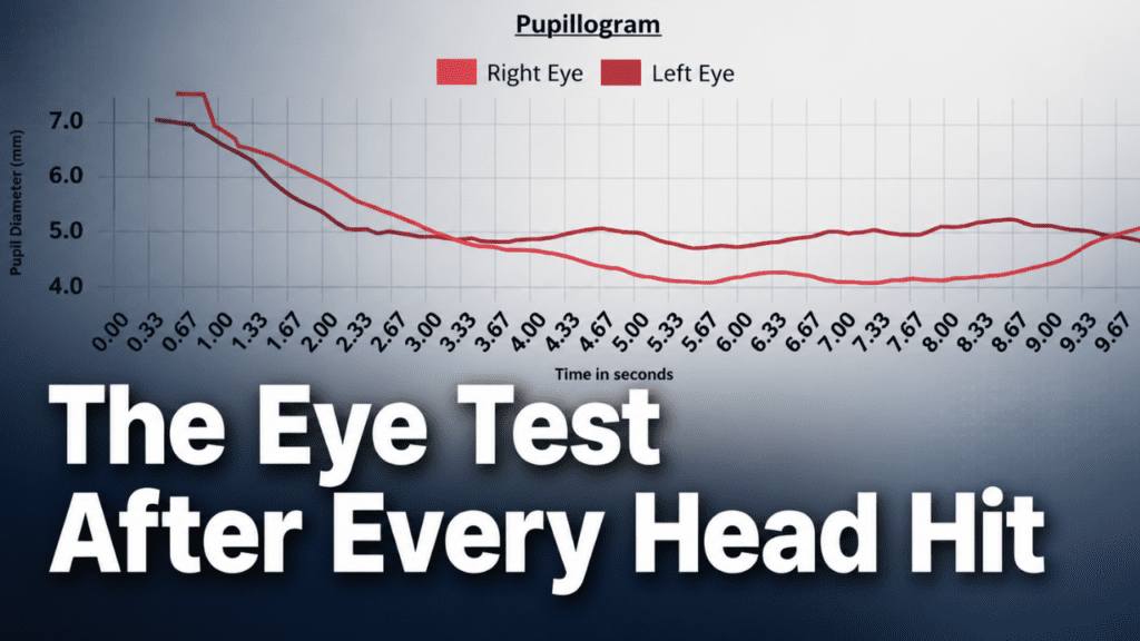 How to Check for a Concussion in Eyes